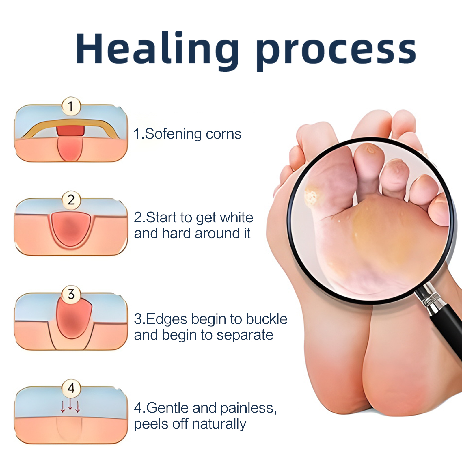 STAETAS 24 miếng miếng dán tẩy da chết Hydrocolloid