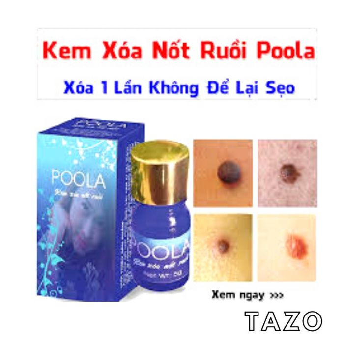Kem xóa nốt ruồi - tàn nhan - Poola - 5g