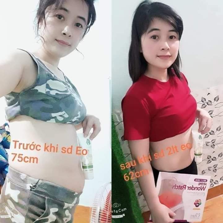 Kem tan mỡ Olic - Tặng 1 miếng dán tan mỡ và thước dây