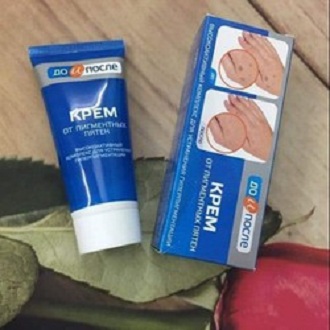 Kem Trí Đồi Mồi Tay Chân Kpem