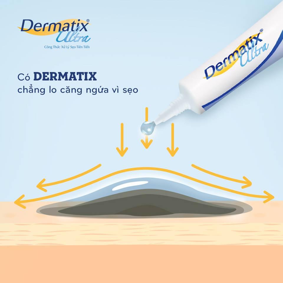 [GIẢM 20K ĐƠN 399K] Dermatix Ultra Gel Làm Mờ Sẹo 7g