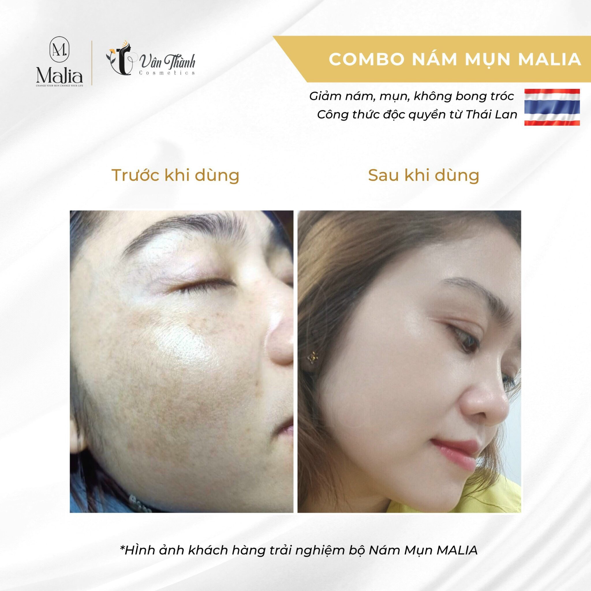 Dưỡng da cao cấp Thái Lan (Full size) Malia - Mẫu mới 2022