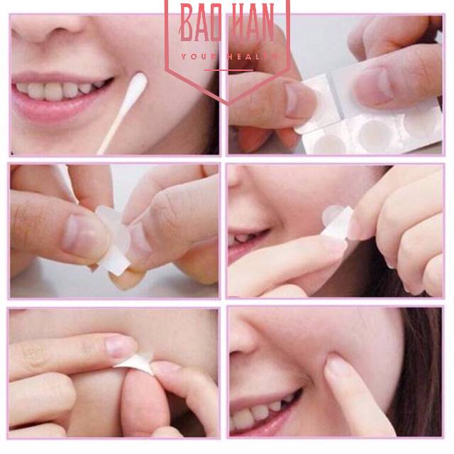 Miếng dán mụn ban ngày Derma Angel (12 miếng/hộp)