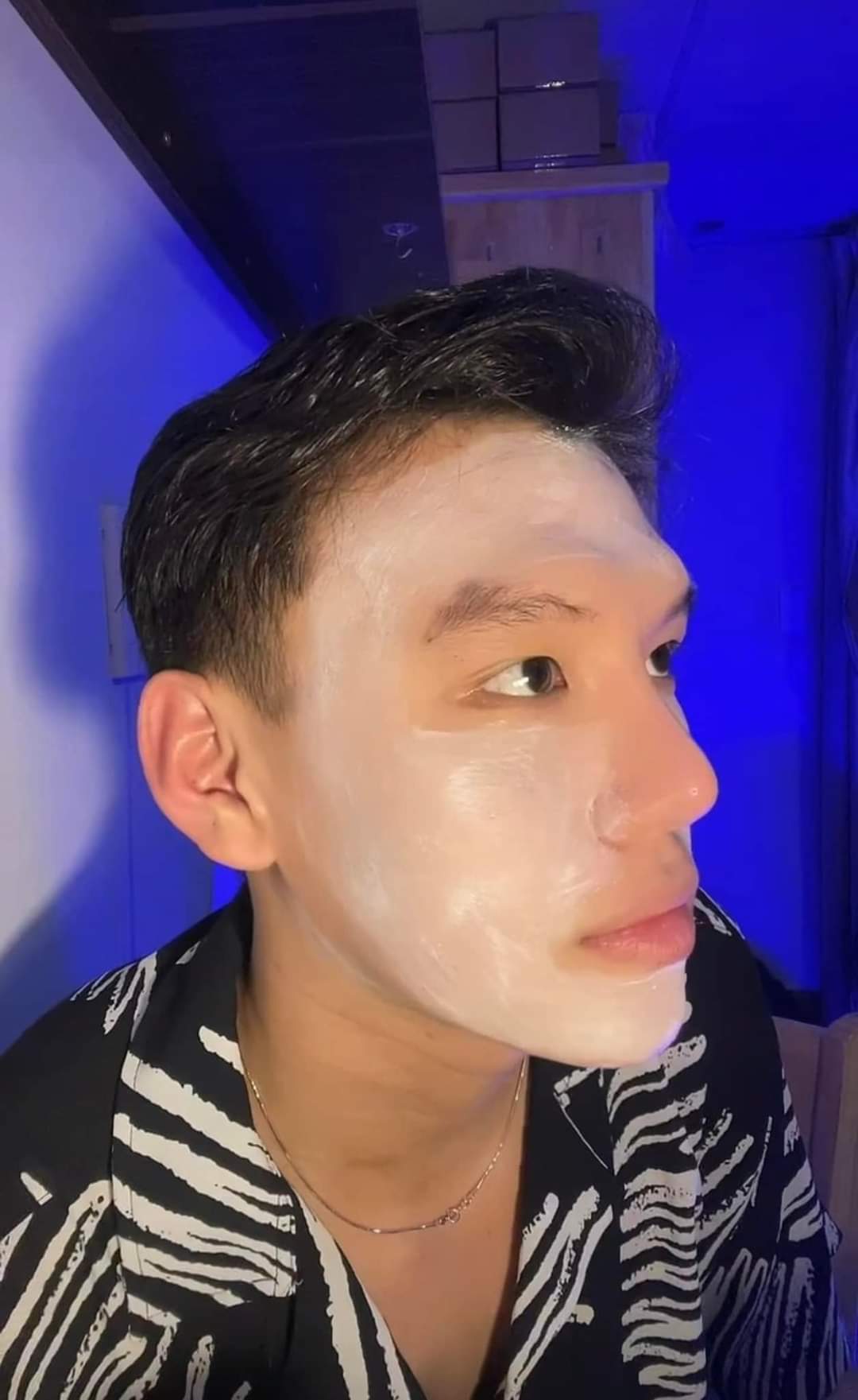 Nạ cấy trắng dưỡng trắng da lành tính