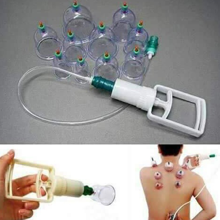 Bộ Giác Hơi 12 Ống Không Dùng Lửa