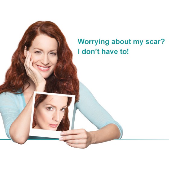 [HCM]Gel trị sẹo MEDERMA Advanced Scar Gel ( 20g )