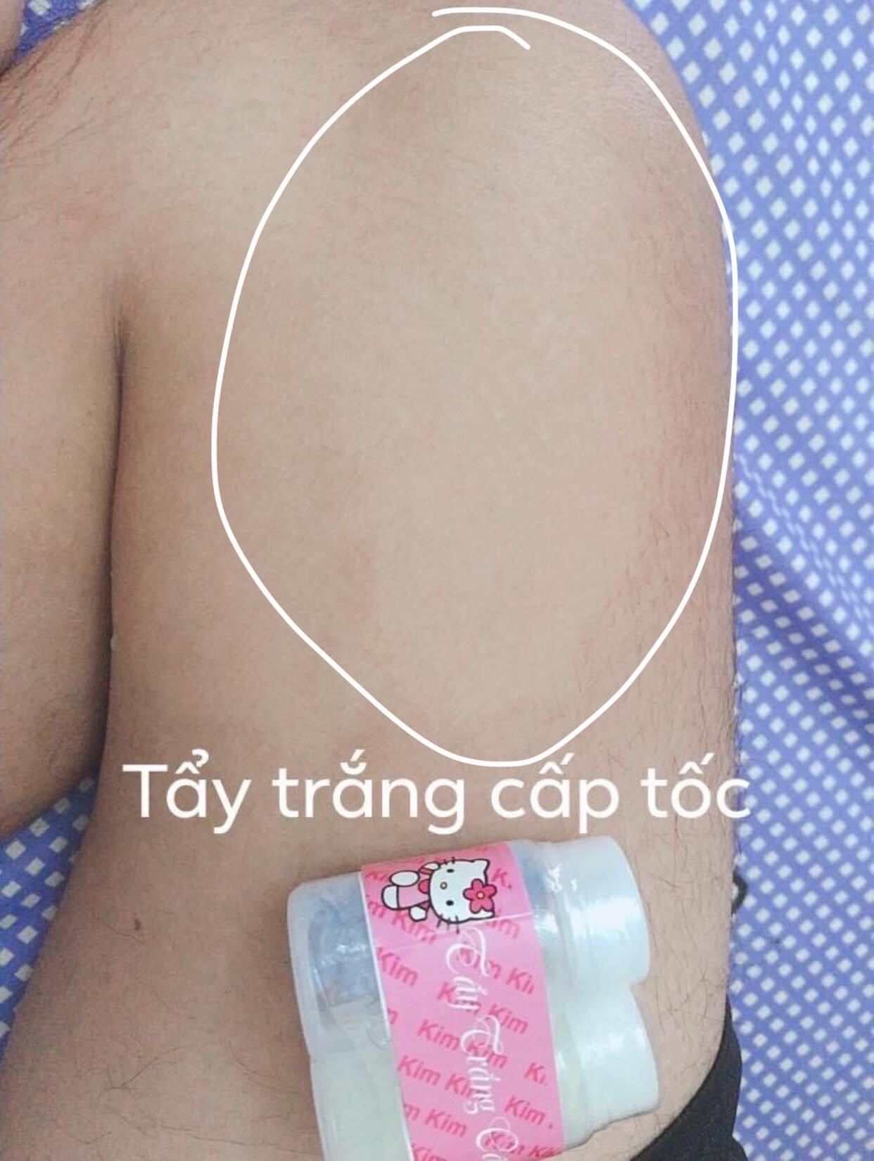 [HCM]Lẻ 1 cặp 2 hủ tẩy trắng cấp tốc mini kimmy