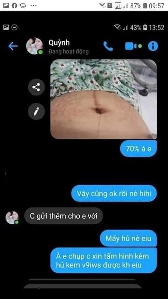 Kem xóa\làm mờ rạn da\thâm da Multi 16
