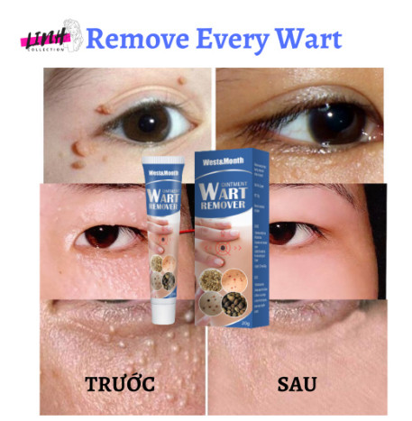 {ĐÁNH BẬT} Mụn Cóc, Mụn Thịt Remove Every Warts