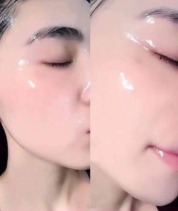 Mat na nhau thai cuu