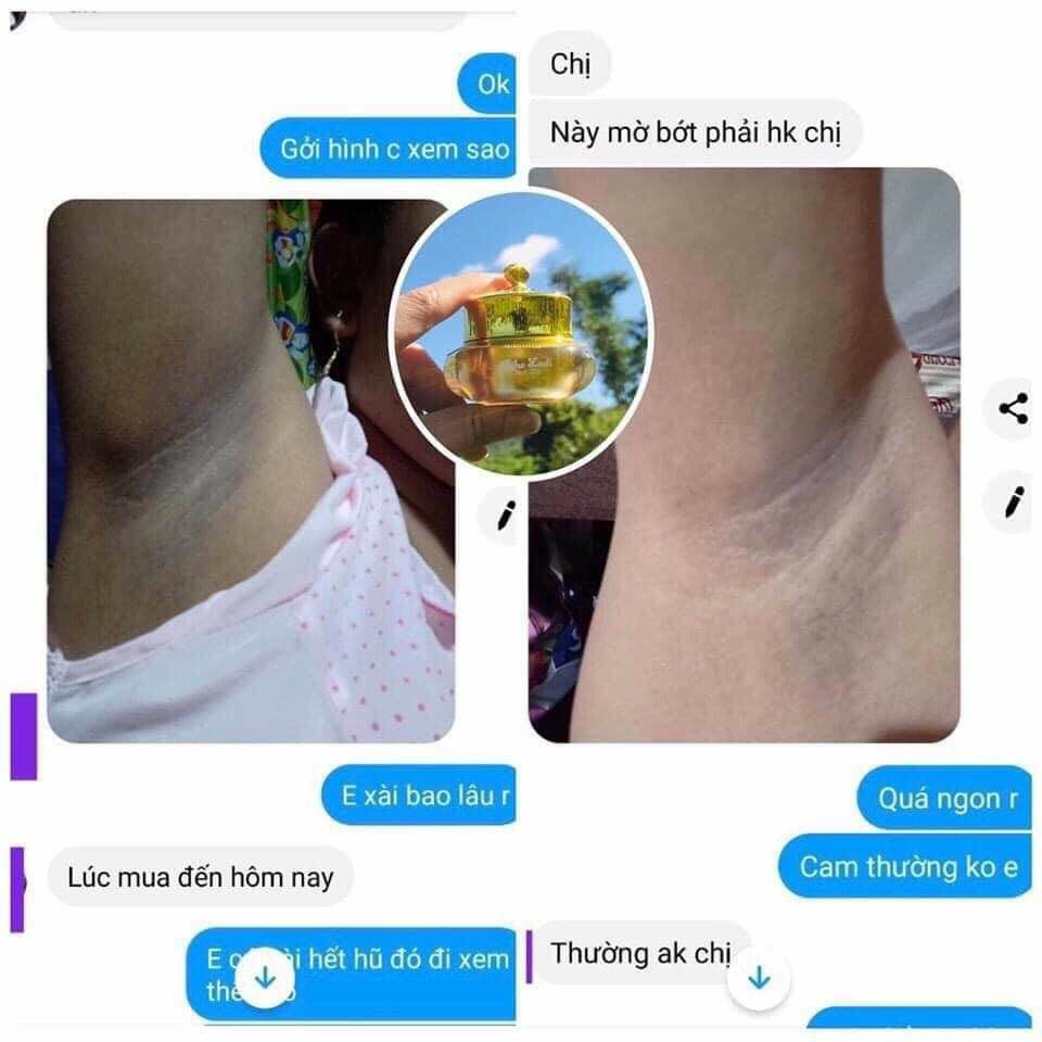 [HÀNG CHÍNH HÃNG] Siêu Dưỡng Thâm 5s Biho ladi