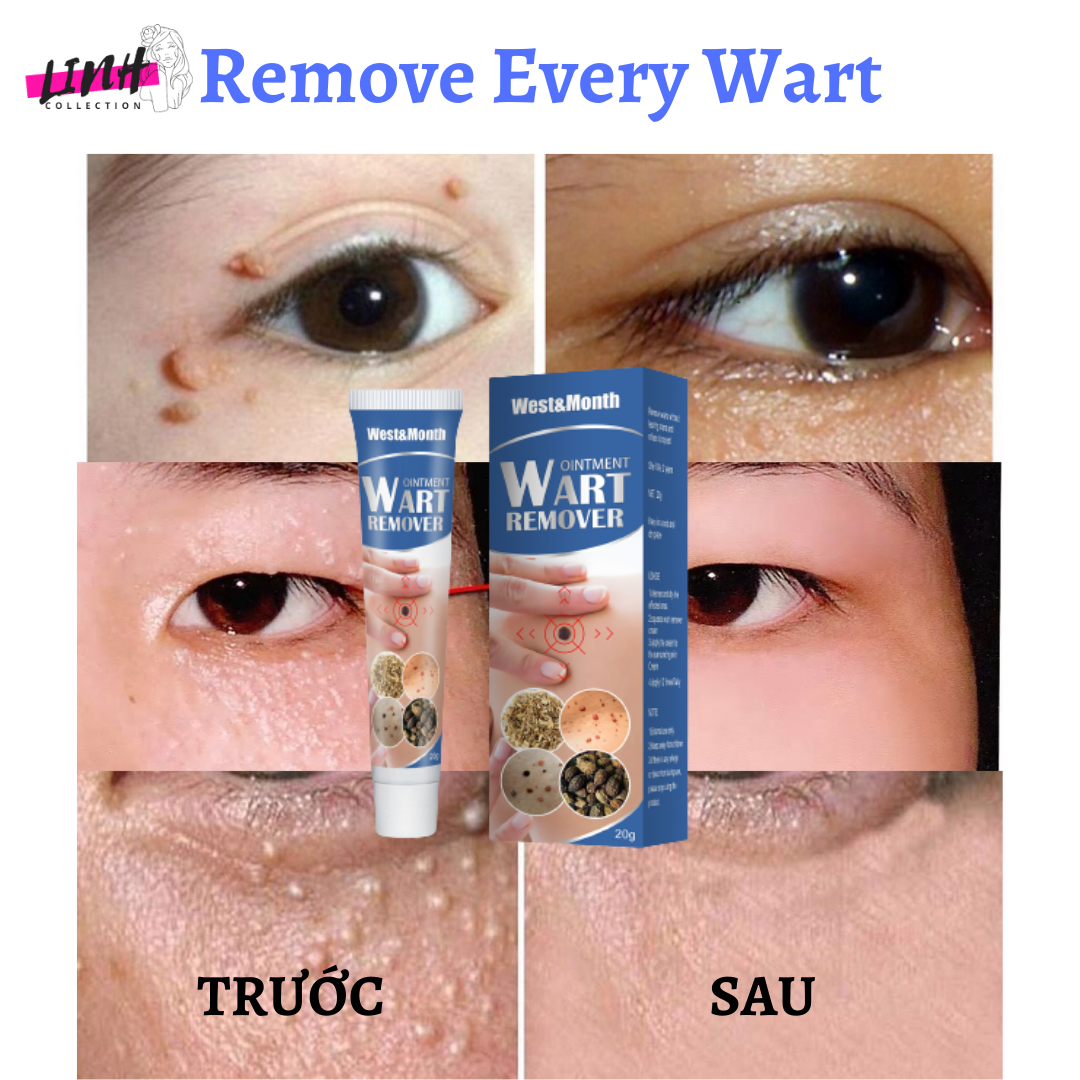 {ĐÁNH BẬT} MỤN CÓC, MỤN THỊT,MỤN CƠM,MỤN RUỒI TRÂU REMOVE EVERY WARTS CHÍNH HÃNG