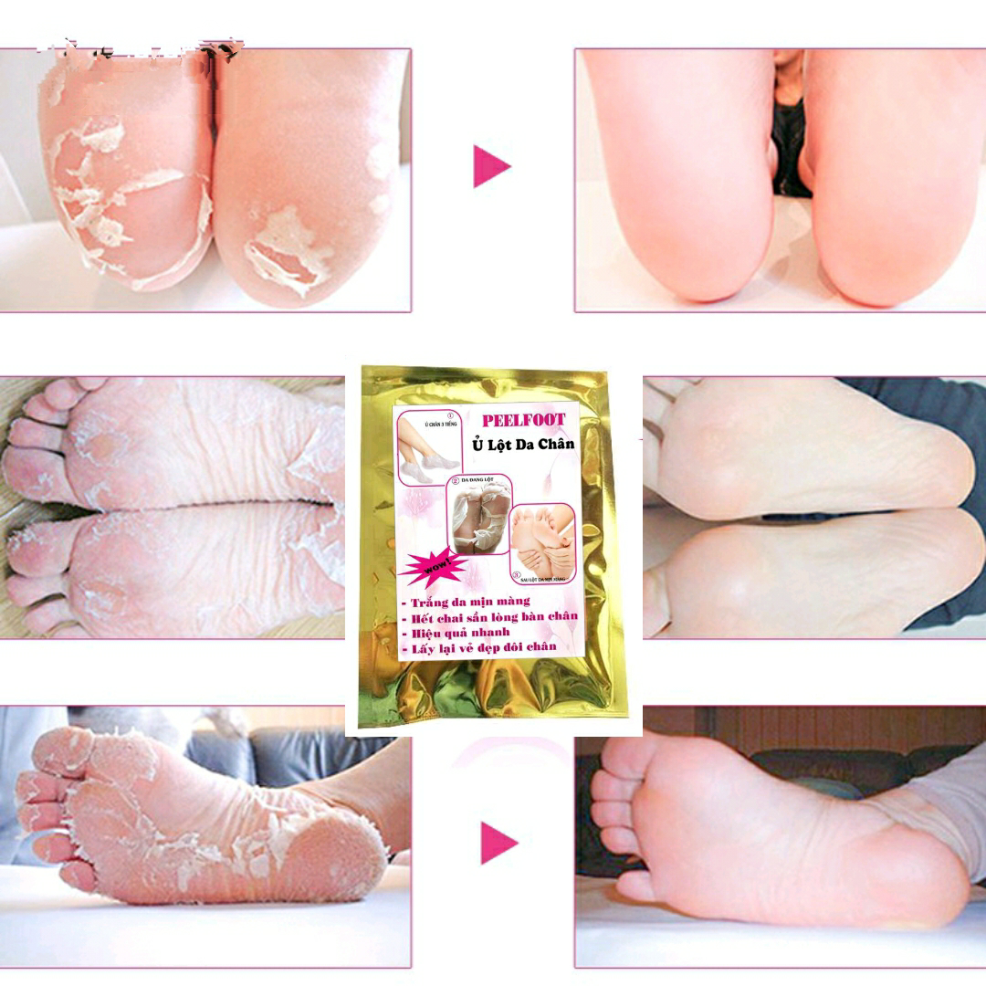 [HCM]Feelfoot Lột Trắng Da Chân Hết Chai Sần