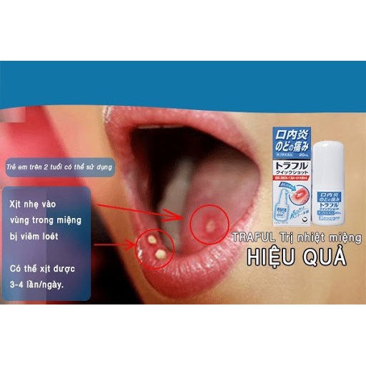 XỊT GIẢM LỠ NHIỆT MIỆNG TRAFUL 20ML [NỘI ĐỊA NHẬT]