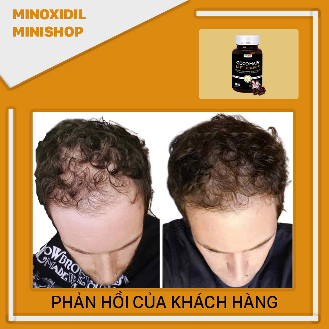 DHT BLOCKER GOOD HAIR MỌC TÓC - NGĂN RỤNG TÓC
