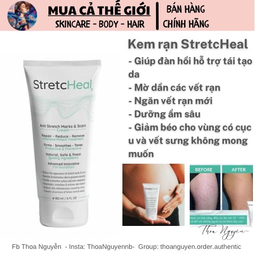 [GIẢM 5% ĐƠN 129K]Kem dưỡng da rạn StretcHeal
