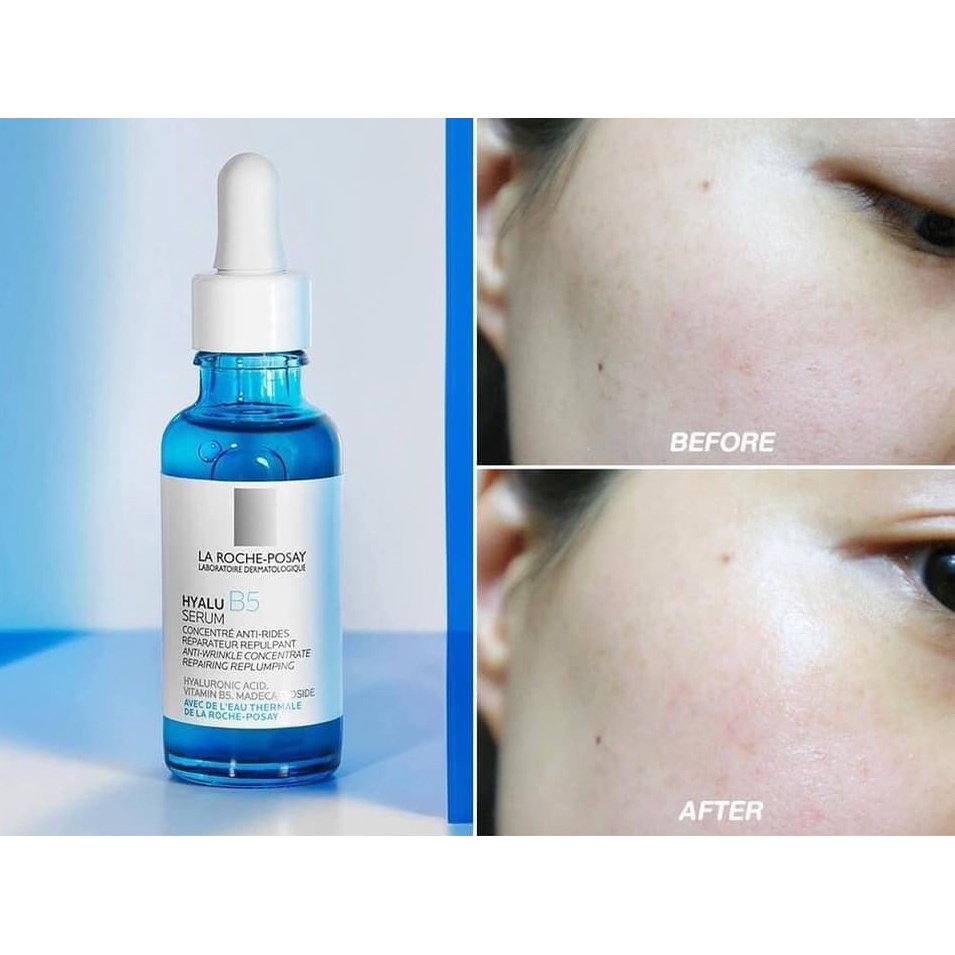 Serum cấp ẩm sâu, phục hồi và tái tạo da La Roche-Posay HYALU B5 Pháp 30ml