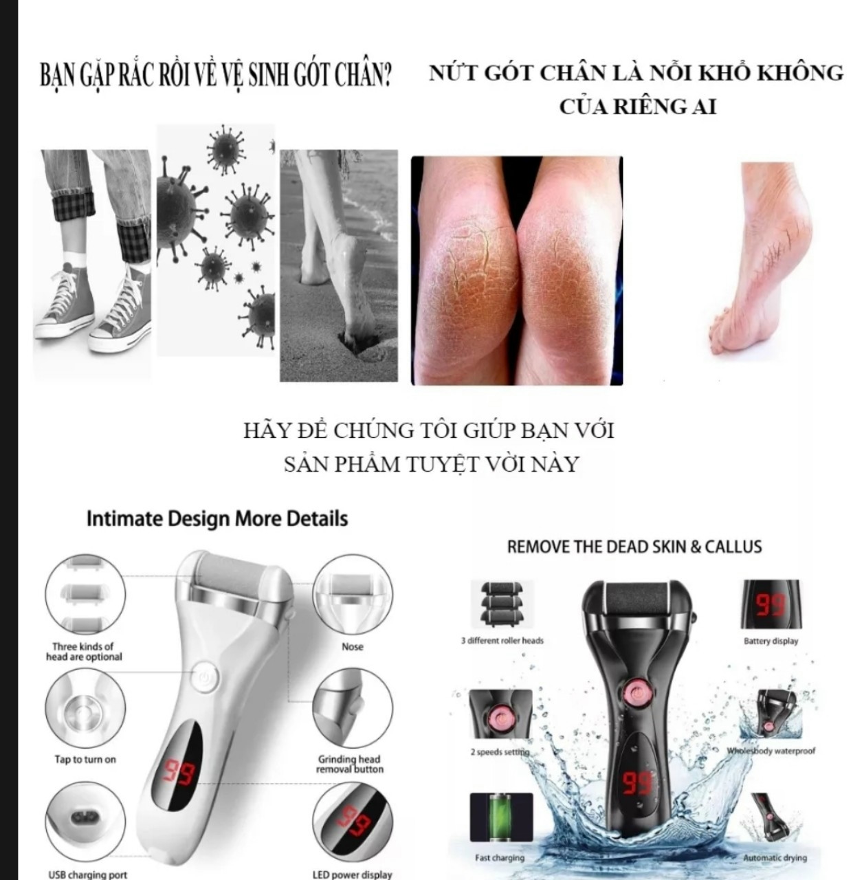 Máy chà gót chân ZCA017- Màu trắng* đen