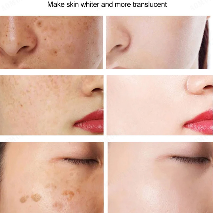 aomulei spot lightening cream moisturizing face cream