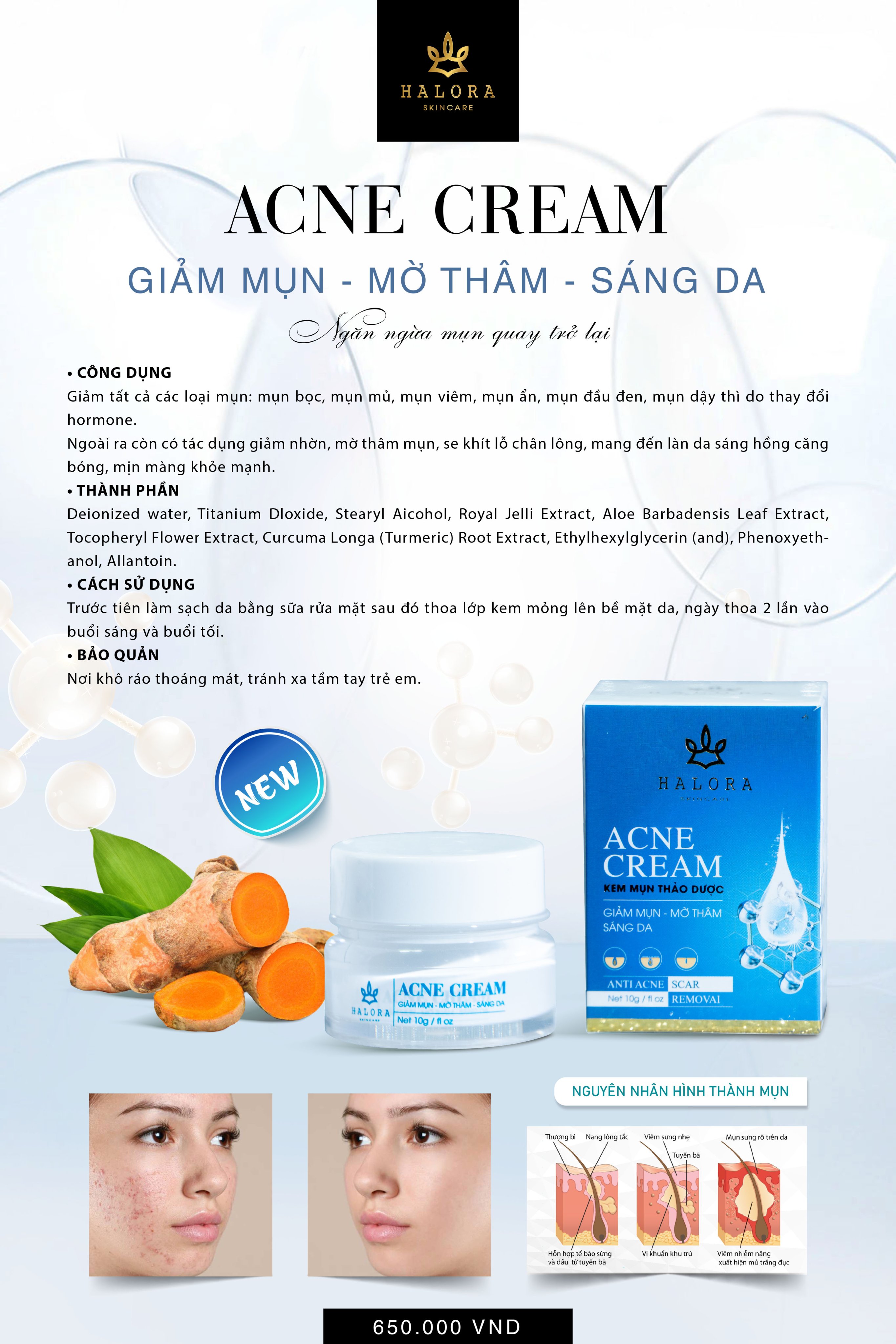 [HCM]Kem Mụn Halora ACNE CREAM