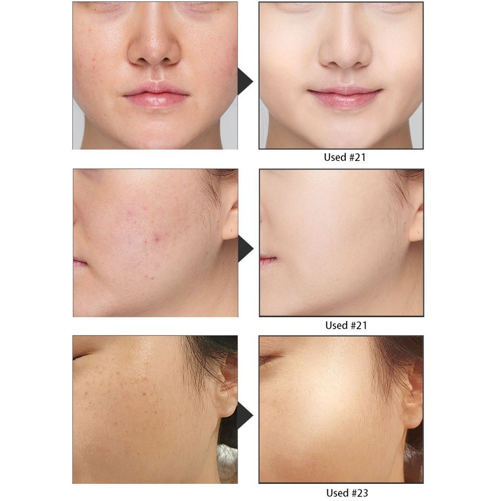 Serum dưỡng trắng Eldas Aura 100ml
