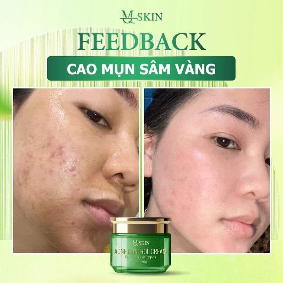 Combo cao mụn sâm vàng + sữa rửa mặt nhân sâm Mqskin