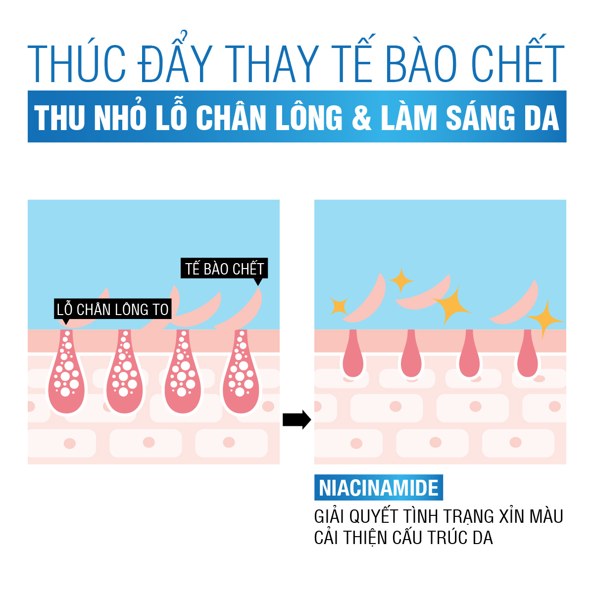 Serum sáng da & thu nhỏ lỗ chân lông Neutrogena® Hydroboost Niacinamide Serum (30ml)