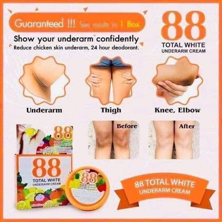 Kem Xóa Thâm 88 TOTAL WHITE Thái Lan