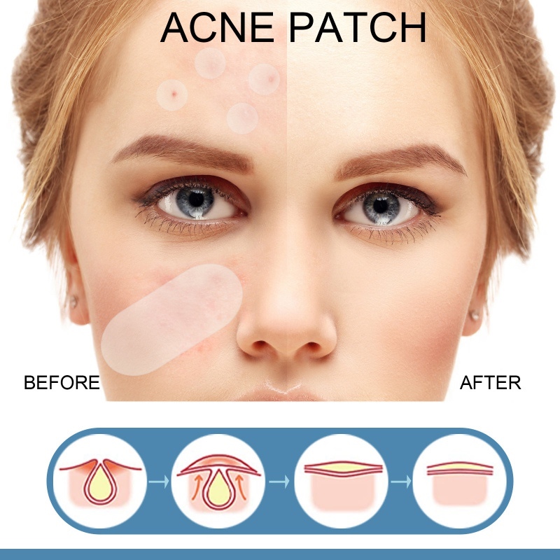 80Pcs Pimple Patch Makeup Invisible Hydrocolloid Comedo Patches