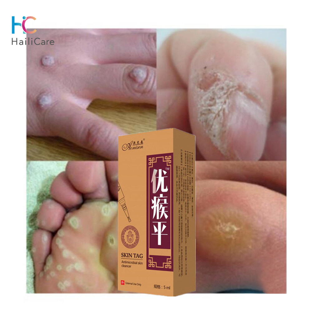 Hailicare Loại bỏ mụn trứng cá Bút 12 giờ Da Thẻ mụn ruồi Tẩy mụn cóc ở chân Bút loại bỏ hạt ngô Hạn chế mụn trứng cá Chất lỏng chăm sóc da Loại bỏ Bộ điều chỉnh Huyết thanh để loại bỏ mụn cóc Phục hồi tái tạo