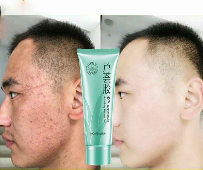 Gel Dưỡng Thể Lô Hội, trị mụn, thị thâm, dưỡng trắng, dưỡng ẩm, làm đẹp tự nhiên thuần khiết, cải thiện sau khi đi nắng, tinh chất lô hội dung tích lớn 40g giá rẻ