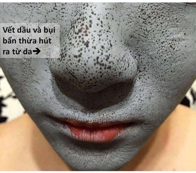 [HCM]Mặt Nạ Bùn Khoáng NEOGENCE Deep Pore Cleasing Đài Loan