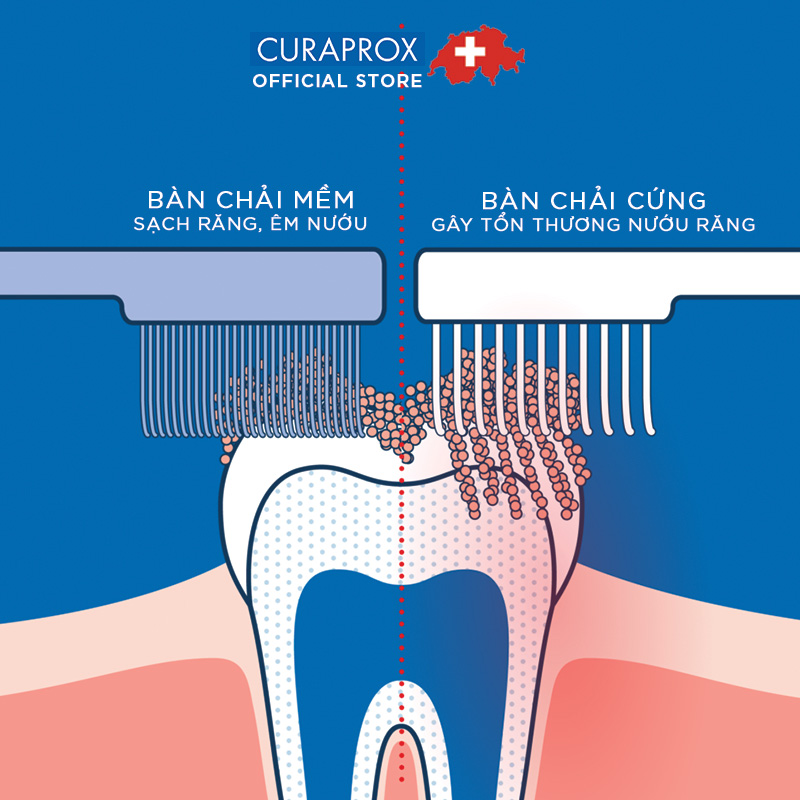 Bàn chải răng siêu mềm CURAPROX CS 1560 Soft
