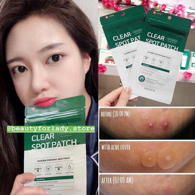 Miếng Dán Mụn Some By Mi Xẹp Mụn Cấp Tốc - Some By Mi Clear Spot Patch (Set 18 miếng)