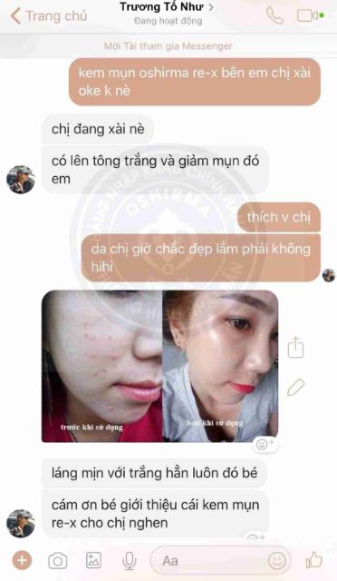 Kem Mụn Mờ Thâm Giảm Nhờn Oshirma 10GR