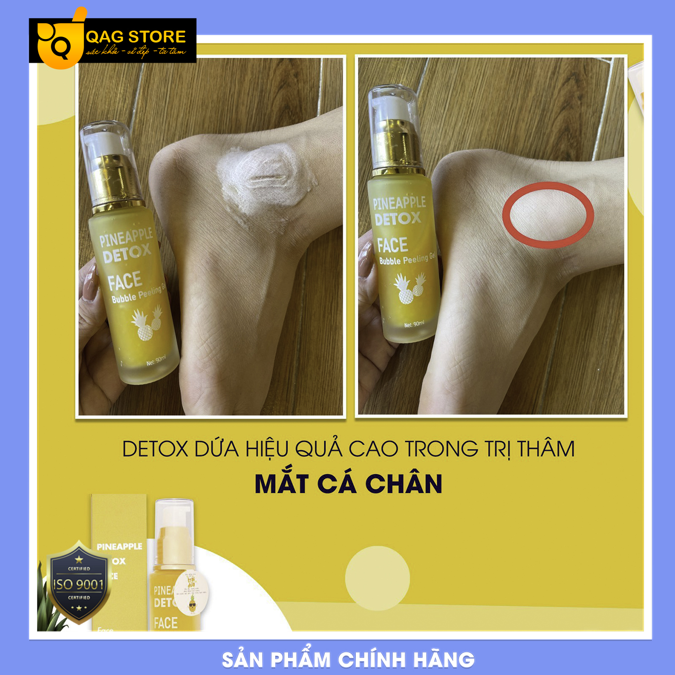 [HCM]THẢI ĐỘC DA DETOX DỨA