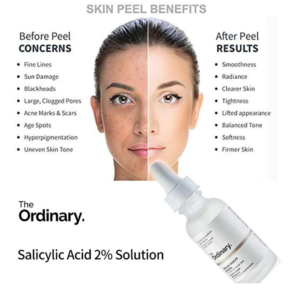 Tinh Chất Giảm mụn The Ordinary Salicylic Acid 2% Solution