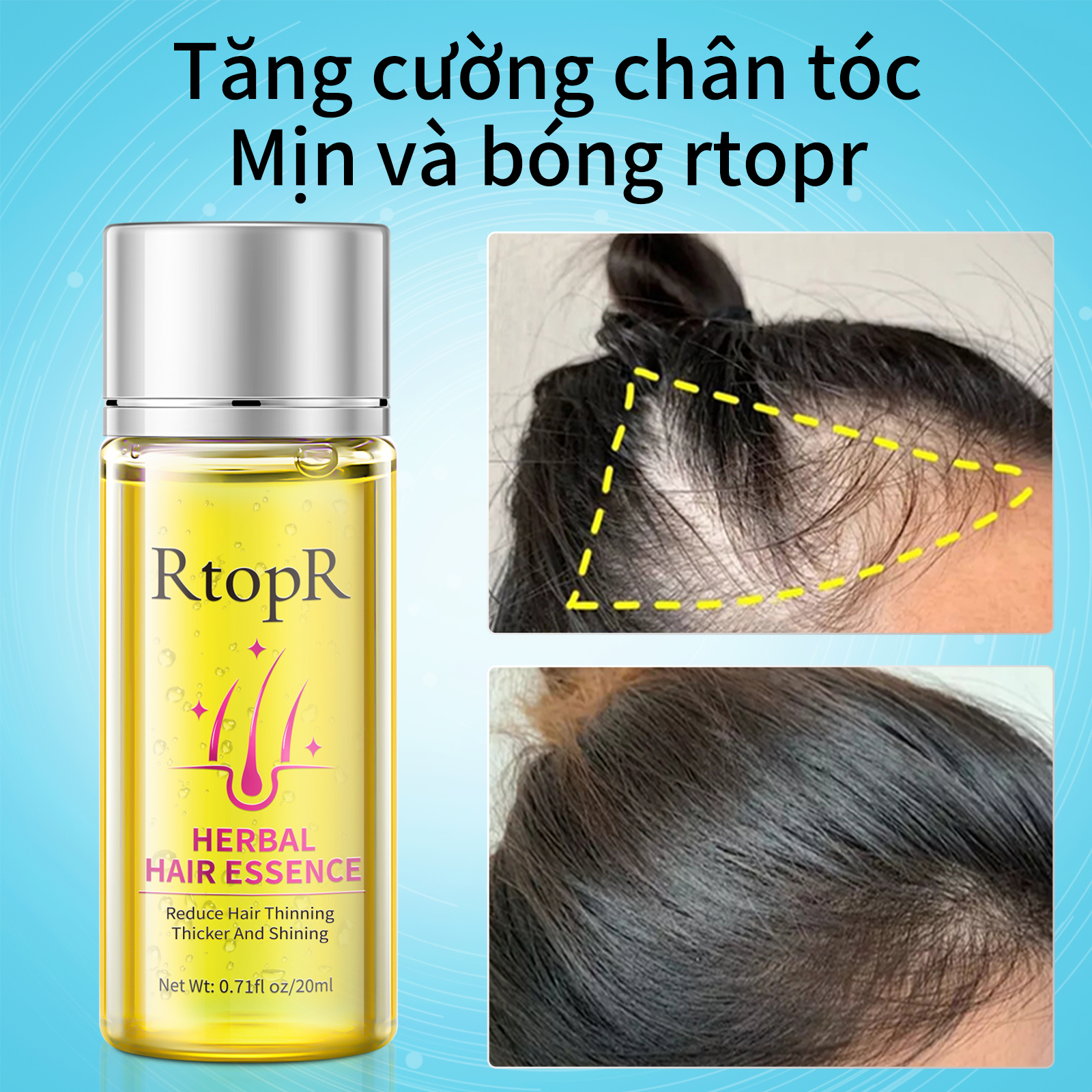 Tinh chất chống rụng tóc và kích thích mọc tóc RtopR - INTL