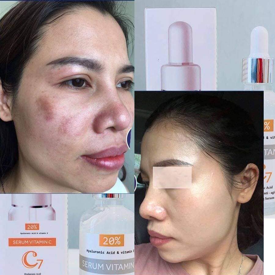 Serum tế bào gốc C7 Hàn Quốc