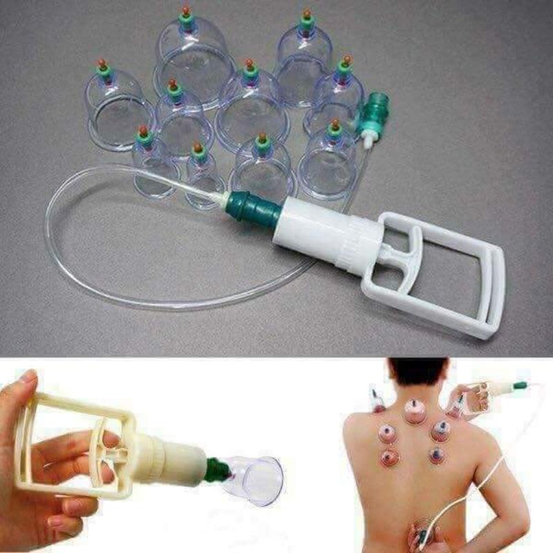 BỘ GIÁC HƠI 12 MÓN KHÔNG DÙNG LỬA