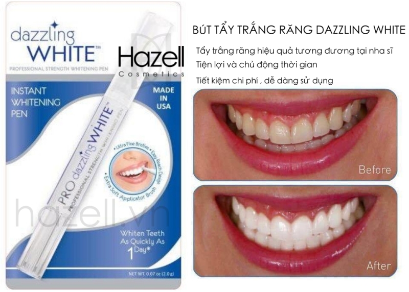 Bút tẩy trắng răng Dazling White