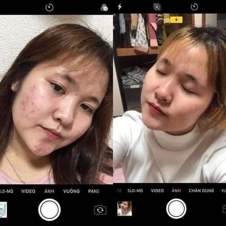 [HCM]Serum Hoa Anh Đào