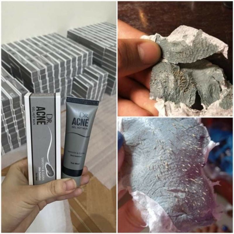 Gel lột mụn đầu đen dr acne