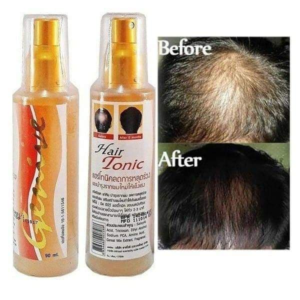 Xịt Mọc Tóc, Hói Đầu GENIVE HAIR TONIC Thái Lan