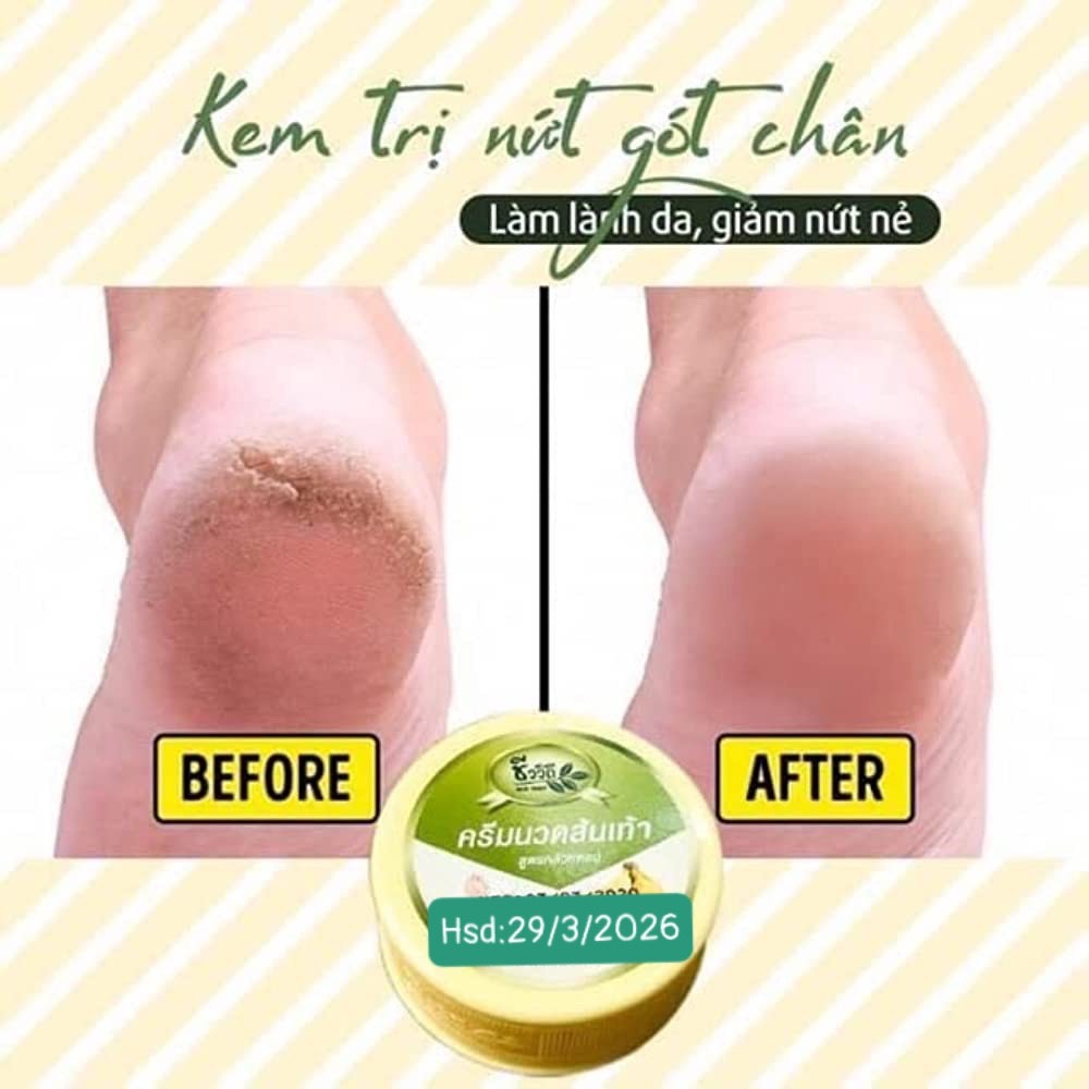 Kem Hổ Trợ  Nứt Gót Chân Chuối Thái Lan