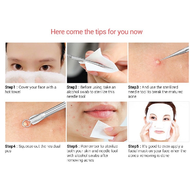 Cây Nặn Mụn 2 Đầu - Que Nặn Mụn Không Gỉ