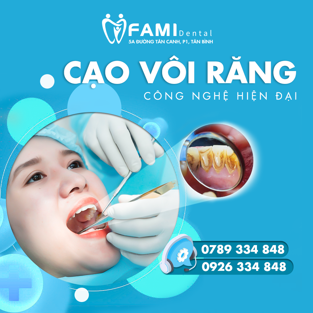 HCM - Voucher cạo vôi răng + đánh bóng răng