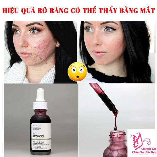 serum The Ordinary AHA 30% + BHA2 % Peeling Solution - 30ml