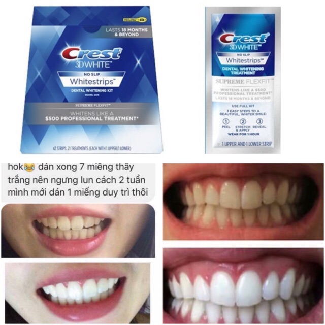 Combo  miếng dán trắng răng Crest 3D White Supreme Flexfit