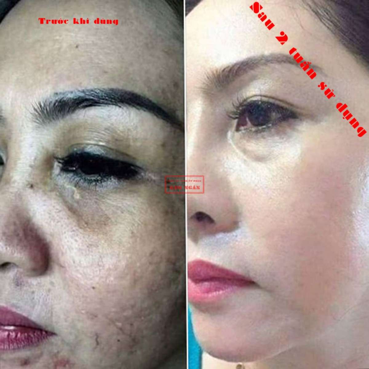 [HCM]Kem Trà Xanh Sạch Mụn Xóa Thâm Mờ Sẹo (13g)
